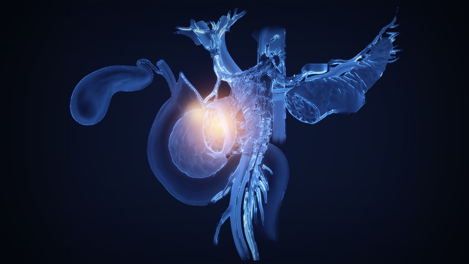 Mesopâncreas: a região "invisível" que pode definir o sucesso da cirurgia de câncer de pâncreas